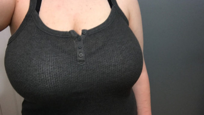 10 Advantages of Getting Breast Reduction Surgery