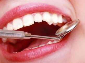 3 Common Dental Problems and How to Deal With Them