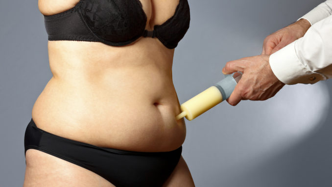 Benefits and Risks of Liposuction