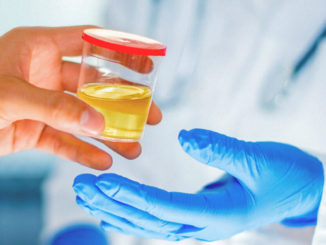 Can You Fail a Drug Test Because of Urine Temperature?