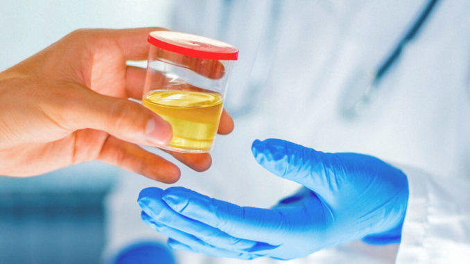 Can You Fail a Drug Test Because of Urine Temperature?