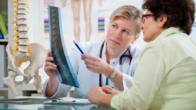 Osteoporosis in Women: What You Need to Know