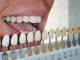 how to whiten your dentures